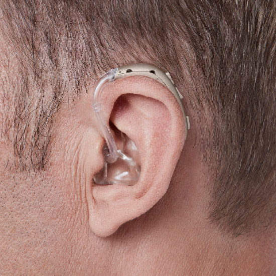 Nulltarif-Hörsysteme von der Krankenkasse